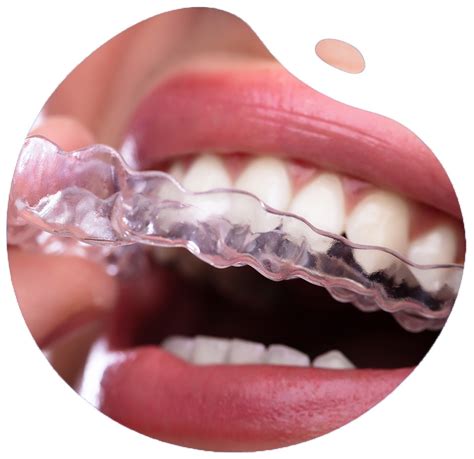 Straighten Your Teeth Effortlessly with a Magical Teeth Aligner